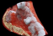 বিশ্বের প্রথম ‘রঙিন ও থ্রিডি এক্স-রে’ করলেন গবেষকরা