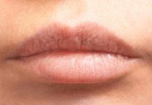 ঠোঁটের কালচে দাগ?