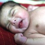 এবার ব্যথামুক্ত স্বাভাবিক প্রসব হবে বাংলাদেশেই