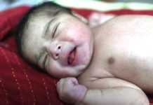 এবার ব্যথামুক্ত স্বাভাবিক প্রসব হবে বাংলাদেশেই