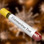 চট্টগ্রামে পৌঁছেছে করোনাভাইরাস শনাক্তের কিট